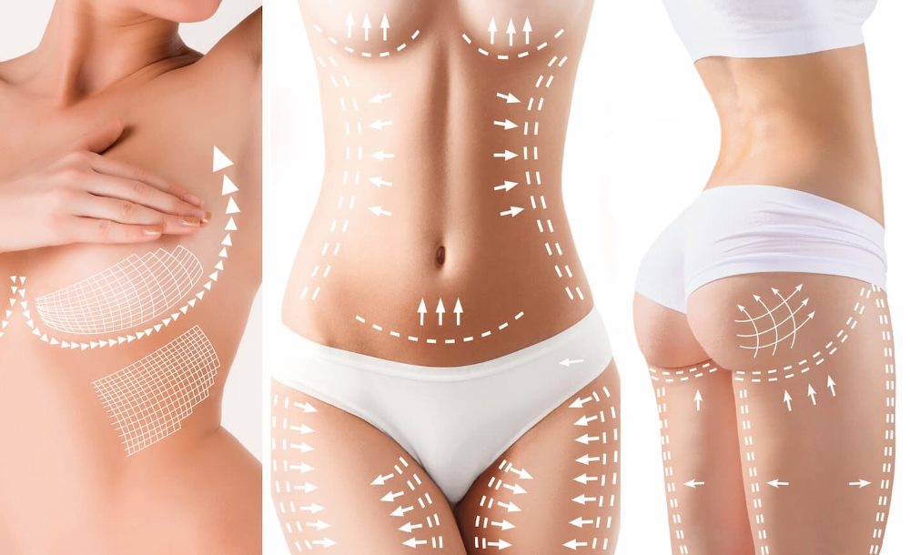 Prvi put na našim prostorima - Total Body Lift